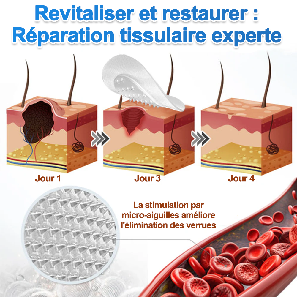 ✨Patch 2-en-1 Curalona® : Microneedle & Hydrocolloïde✨ | Élimine les grains de beauté en relief, les verrues planes et les acrochordons | Aide à atténuer les rides, les cicatrices et les imperfections | Patch invisible adapté au visage et au corps