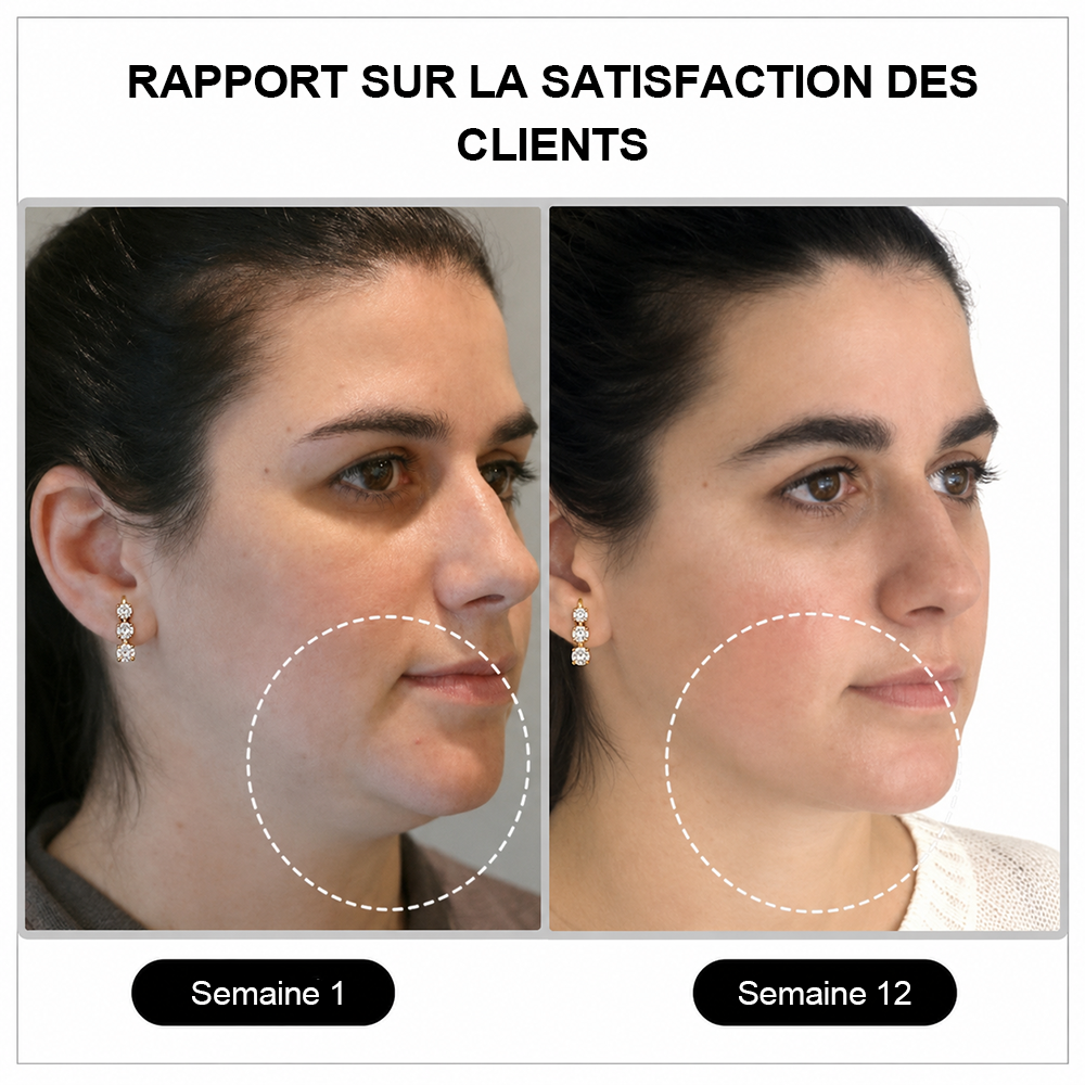 🔥 DERNIER JOUR – JUSQU'À -80 % 💎 Czticle® Boucles d’Oreilles en Germanium Histone Magnetology Lymphvity
