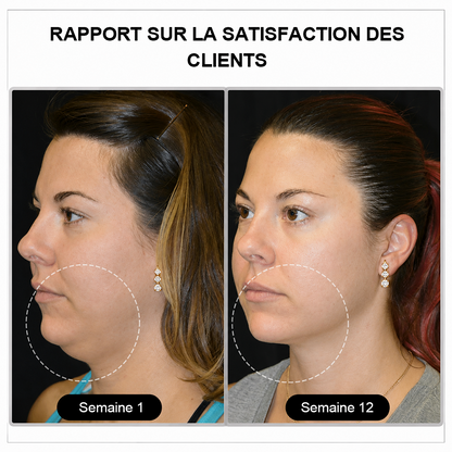 🔥 DERNIER JOUR – JUSQU'À -80 % 💎 Czticle® Boucles d’Oreilles en Germanium Histone Magnetology Lymphvity