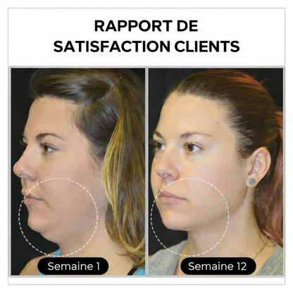 ✨ DERNIER JOUR – SOLDES 80%💎 Czticle® Histone Magnetology Lymphvity Boucles d’Oreilles en Germanium