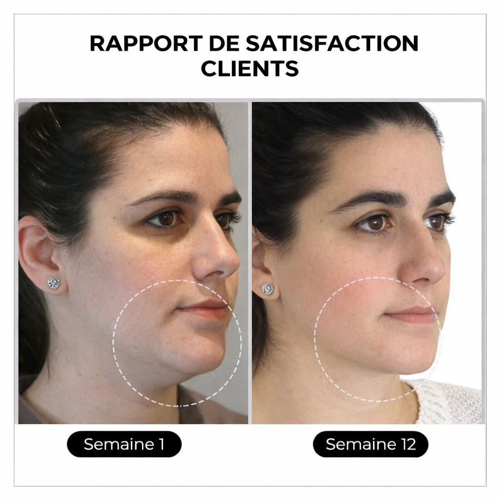 ✨ DERNIER JOUR – SOLDES 80%💎 Czticle® Histone Magnetology Lymphvity Boucles d’Oreilles en Germanium